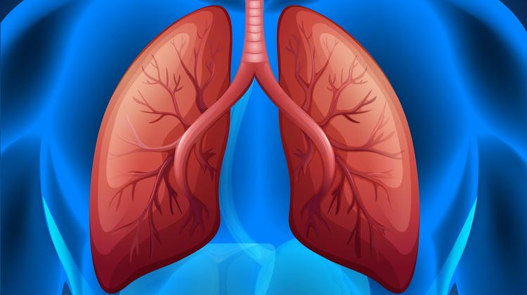 Doença pulmonar por M. avium complex: tempo de conversão e prognóstico