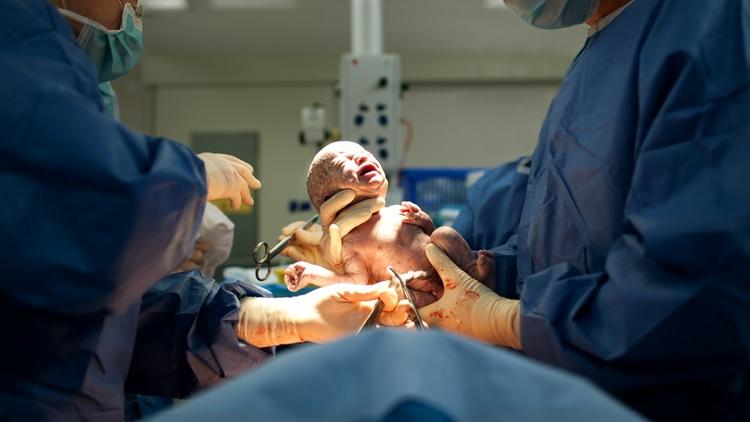 Parto vaginal operatório X cesárea no período expulsivo: qual a opção mais segura