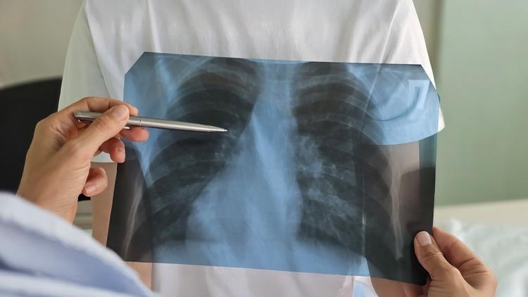 exame de imagem criança