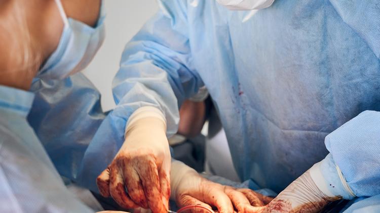 A azatioprina e o risco de câncer de pele não melanoma entre transplantados