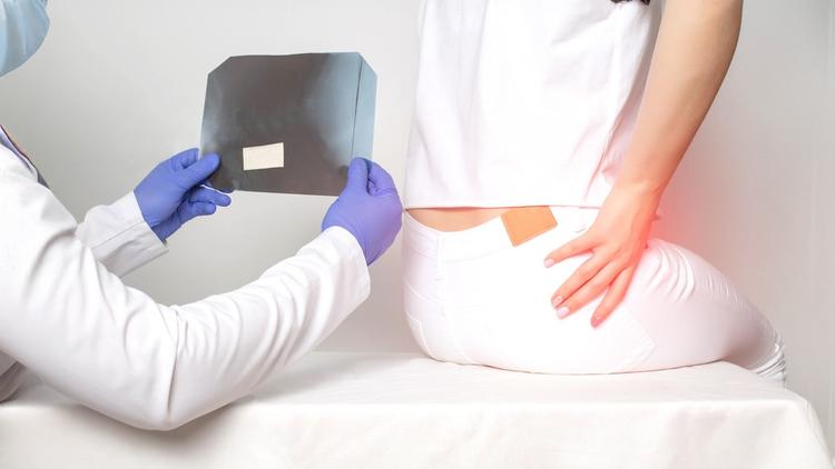 artroplastia quadril jovens