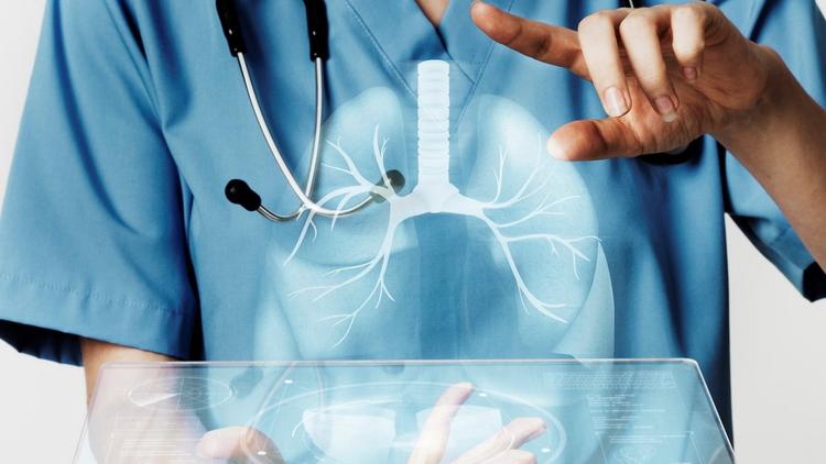 Casos de Influenza A crescem e aumentam números de SRAG no país