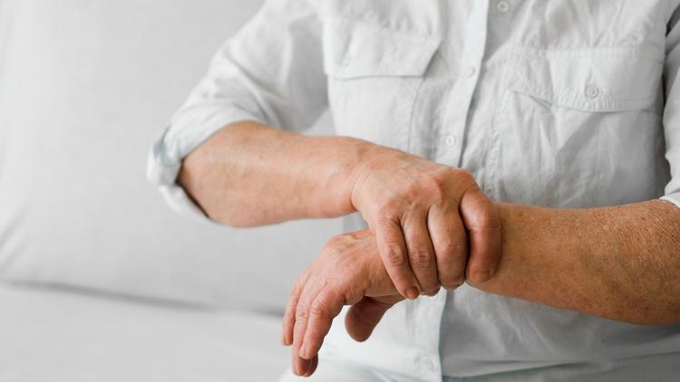 Guselcumabe: Anvisa aprova uso de medicamento para artrite psoriásica