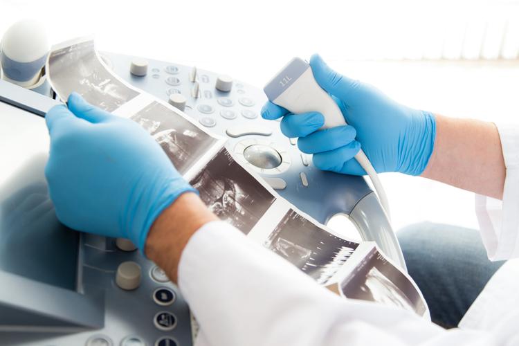 USG diafragmática como preditora de sucesso de extubação em pediatria