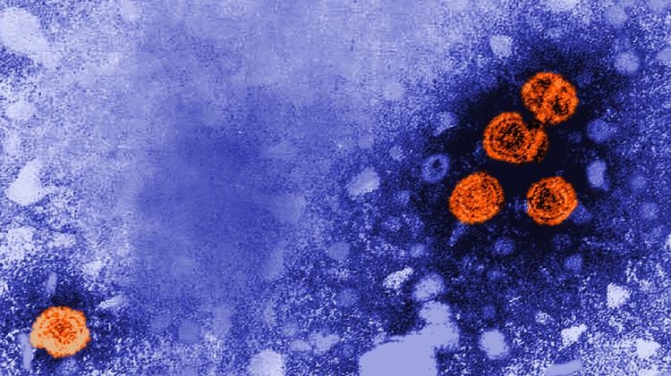 Bepirovirsen na hepatite B crônica: Um passo rumo à cura funcional?