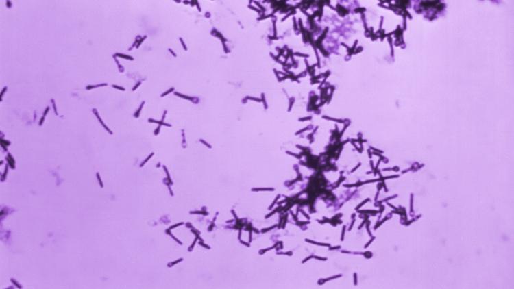 Tétano acidental: estudo revela alta gravidade e mortalidade