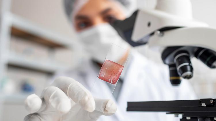 Diretrizes da ASCO oferecem orientações sobre o uso de testes de DNA tumoral circulante (ctDNA) em pacientes com tumores sólidos ou linfoma