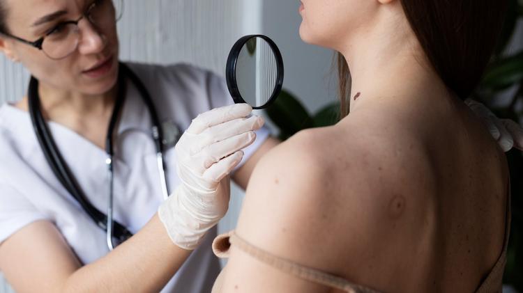 Melanoma cutâneo: o que há de novo na atualização do NCCN para 2026