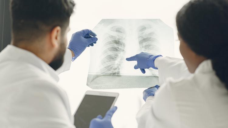 Anvisa aprova primeiro medicamento para hipertensão pulmonar associada à DPI