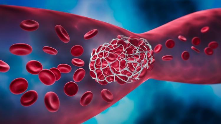 antídotos para anticoagulantes