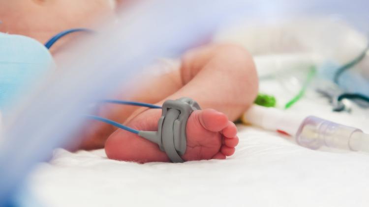 Cateter nasal de alto fluxo na bronquiolite: deve ser a primeira escolha?