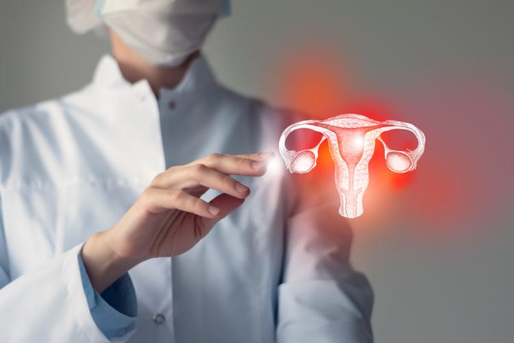 Técnica reconstrói clitóris após tratamento de câncer vulvar